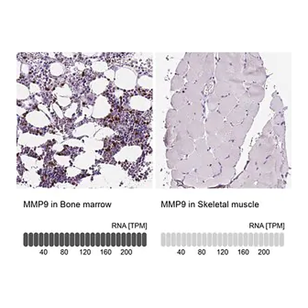 Merck Anti-MMP9 antibody produced in rabbit