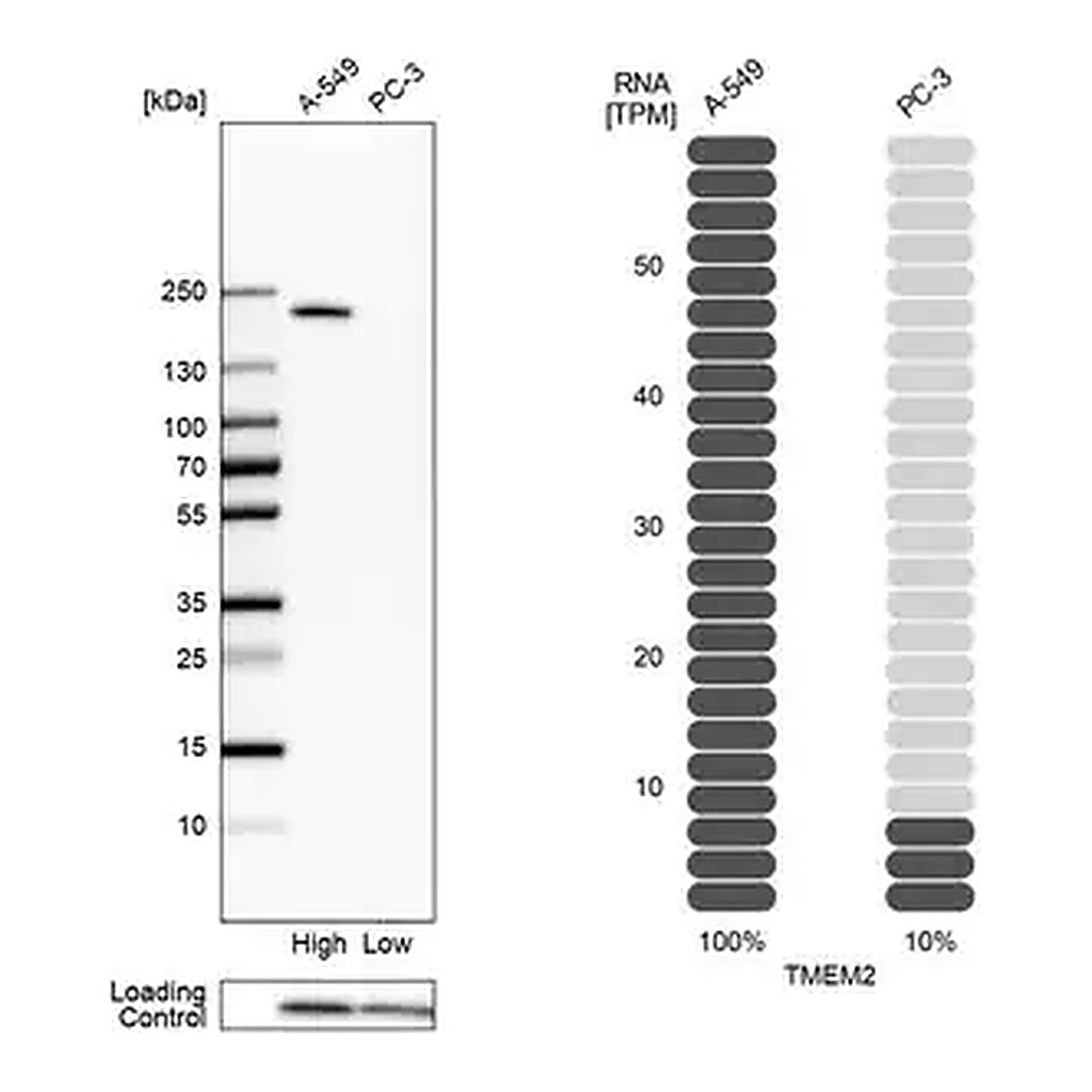 Merck Anti-TMEM2 antibody produced in rabbit