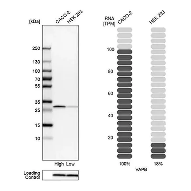 Merck Anti-VAPB antibody produced in rabbit