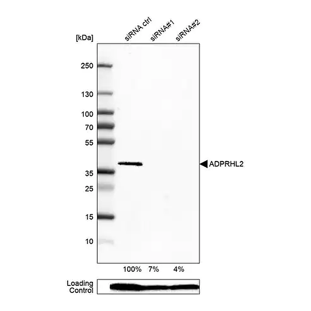Merck Anti-ADPRHL2 antibody produced in rabbit