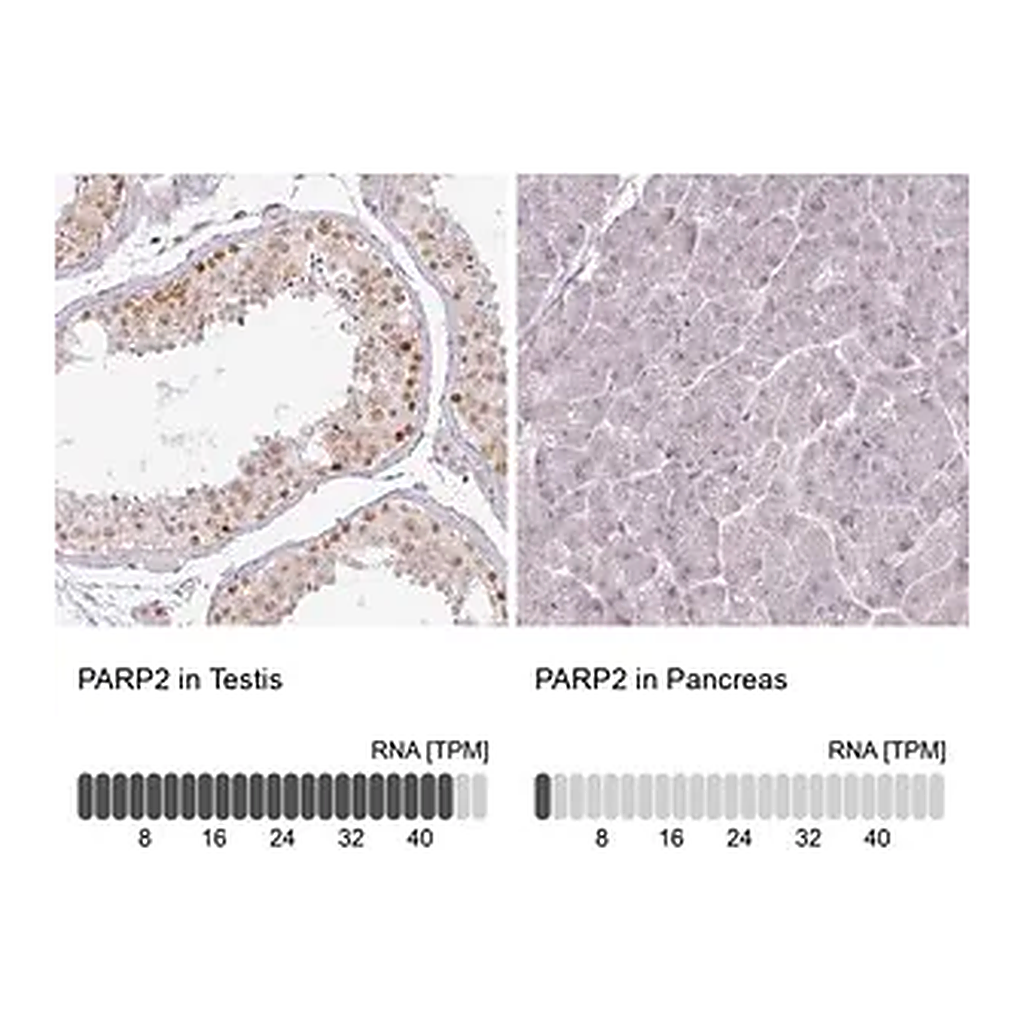 Merck Anti-PARP2 antibody produced in rabbit