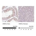Merck Anti-PARP2 antibody produced in rabbit