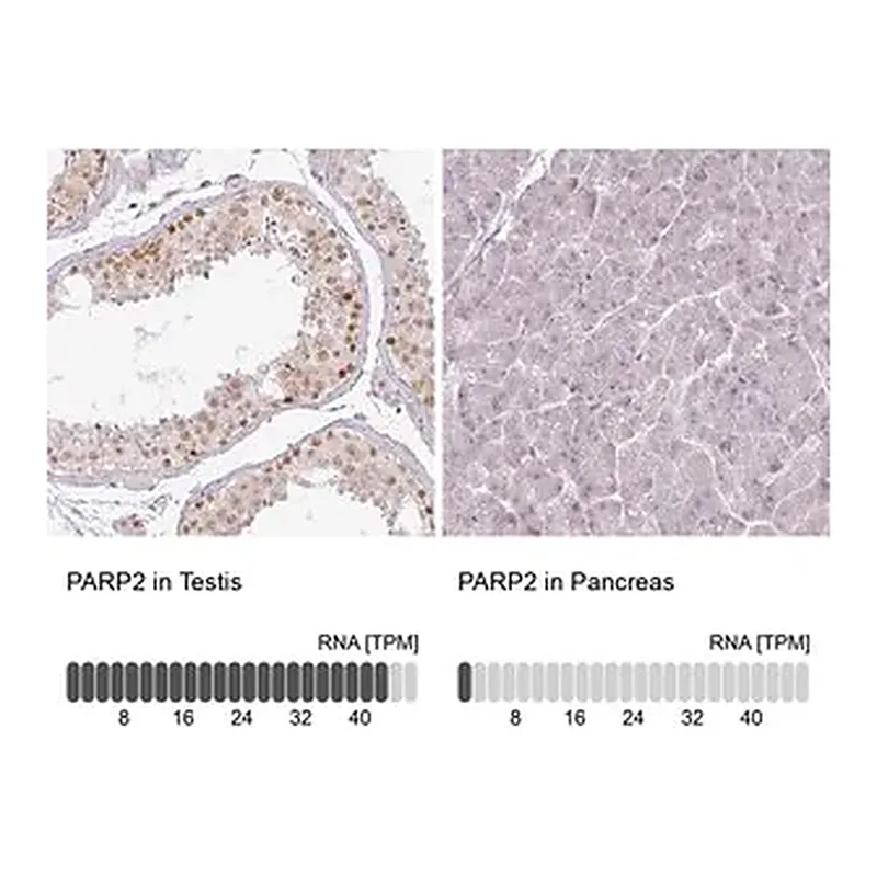 Merck Anti-PARP2 antibody produced in rabbit
