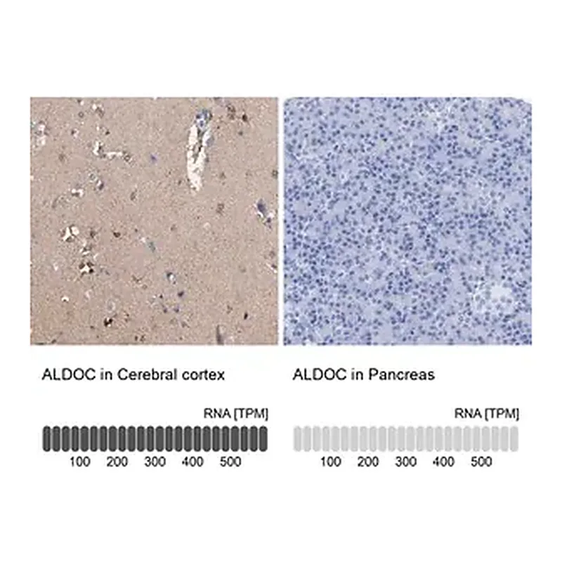 Merck Anti-ALDOC antibody produced in rabbit