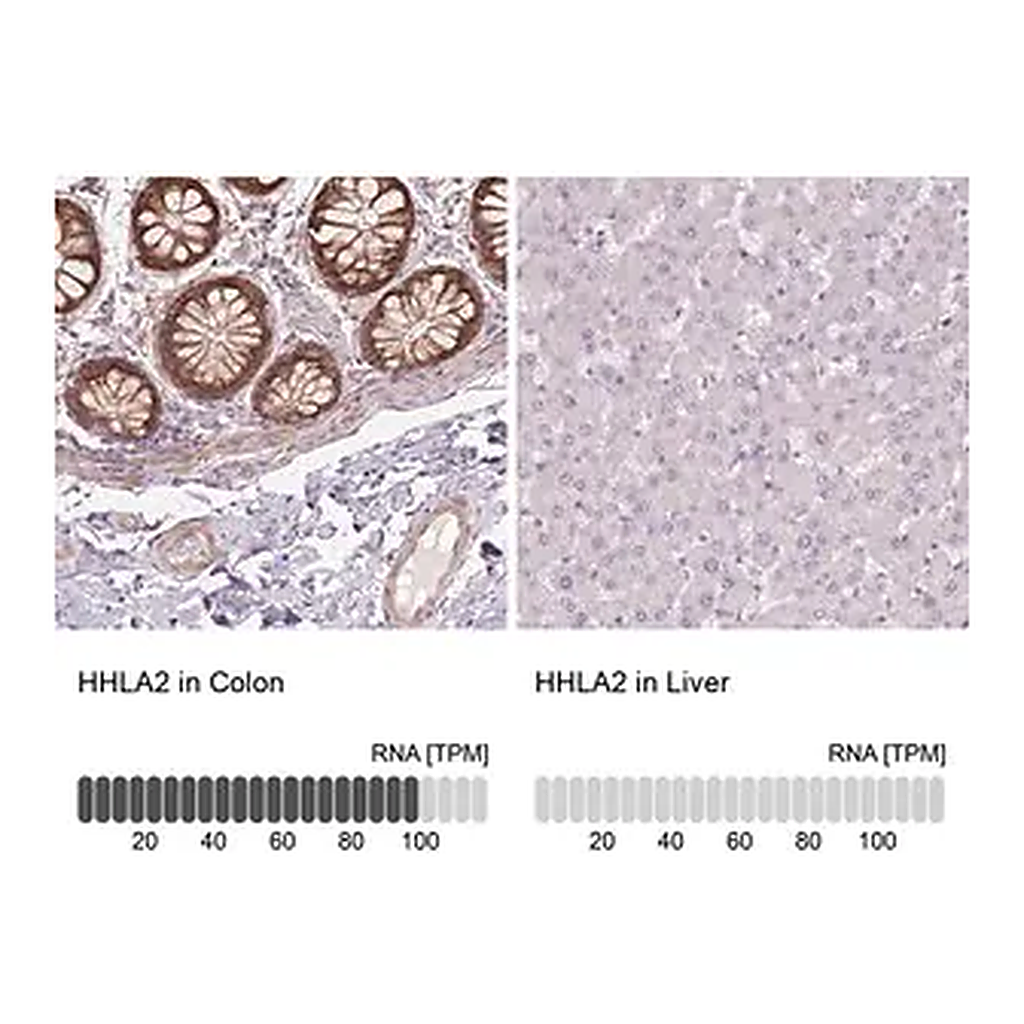 Merck Anti-HHLA2 antibody produced in rabbit