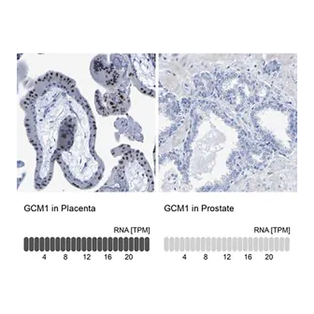 Merck Anti-GCM1 antibody produced in rabbit