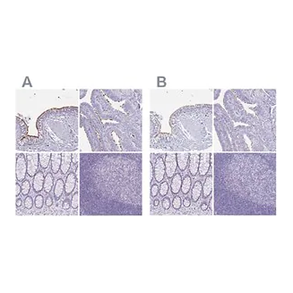 Merck Anti-CCDC39 antibody produced in rabbit