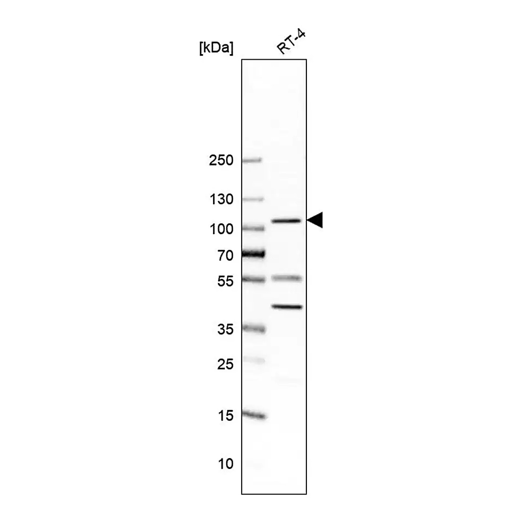Merck Anti-UBE3A antibody produced in rabbit