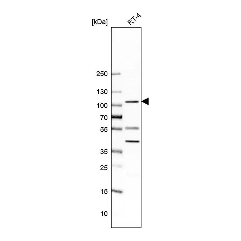 Merck Anti-UBE3A antibody produced in rabbit