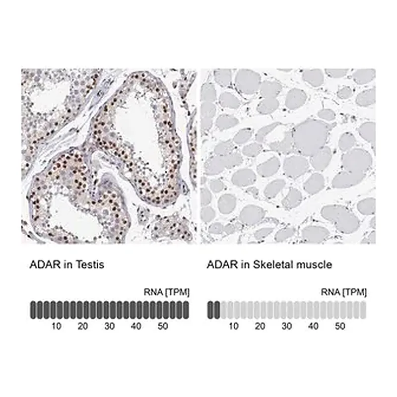 Merck Anti-ADAR antibody produced in rabbit