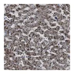 Merck Anti-ACAA1 antibody produced in rabbit