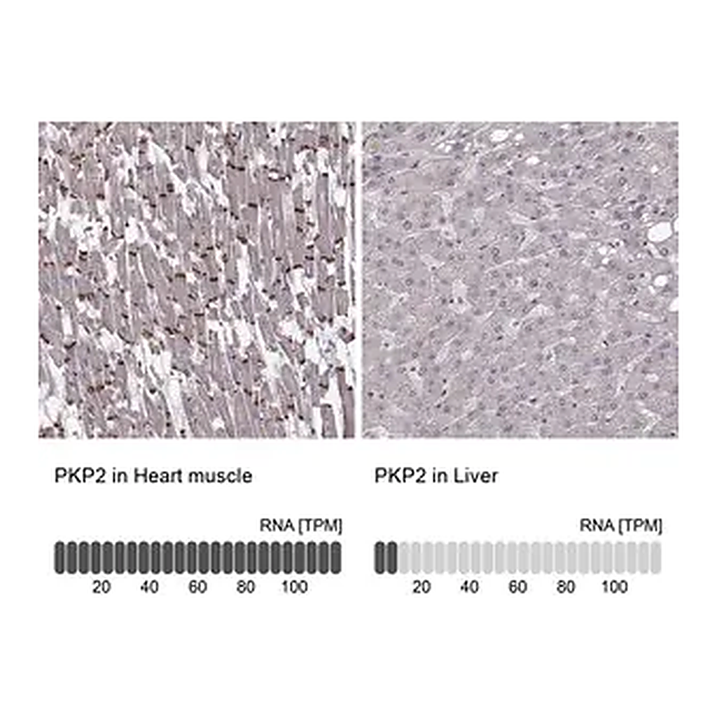 Merck Anti-PKP2 antibody produced in rabbit