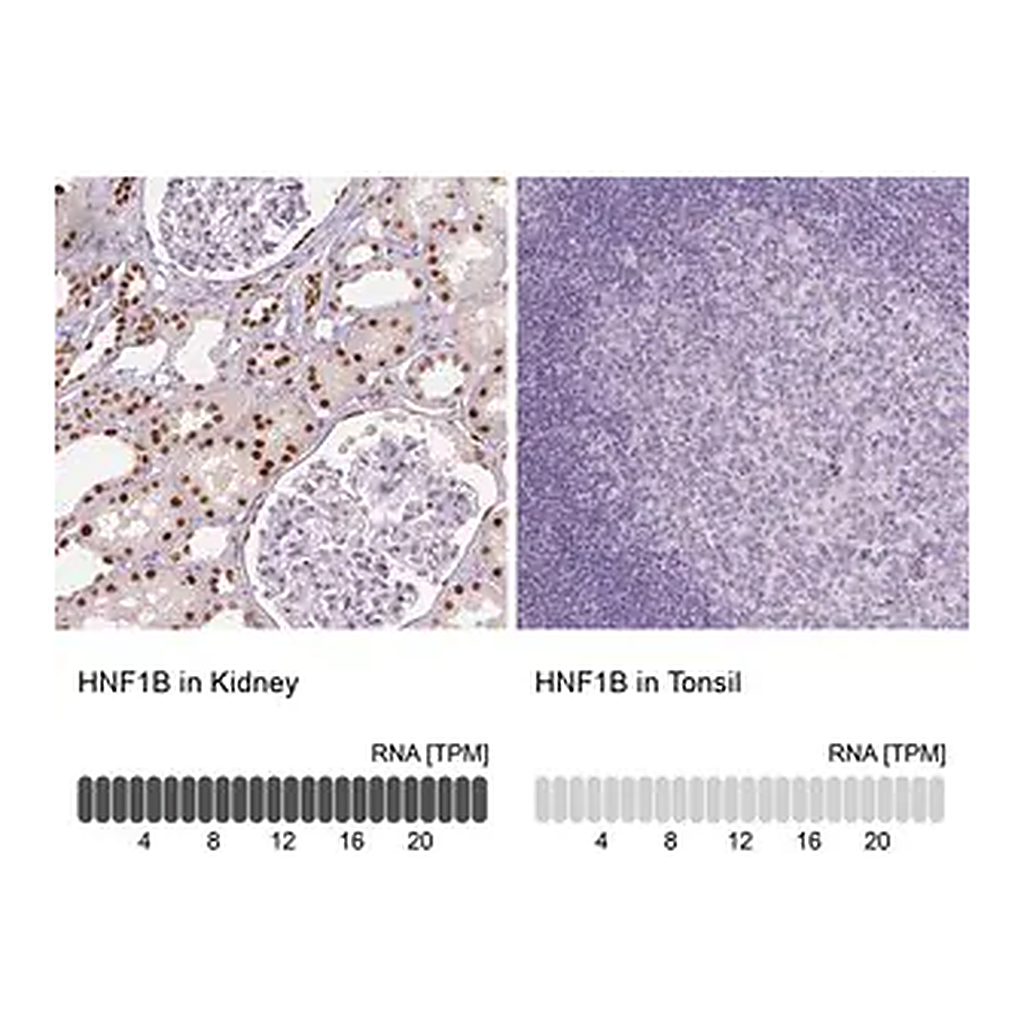 Merck Monoclonal Anti-HNF1B antibody produced in mouse