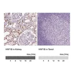 Merck Monoclonal Anti-HNF1B antibody produced in mouse
