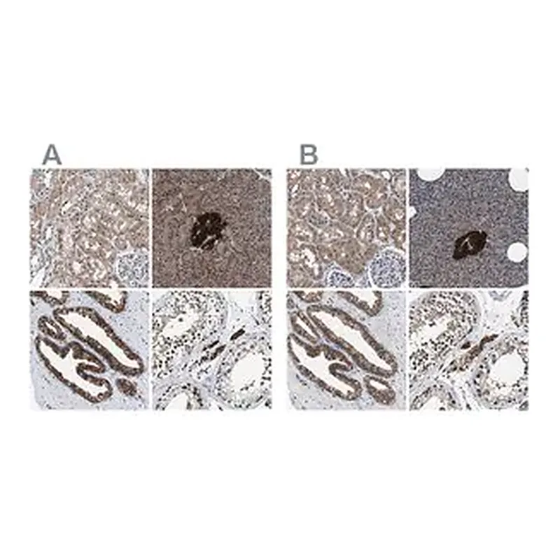Merck Anti-ACLY antibody produced in rabbit