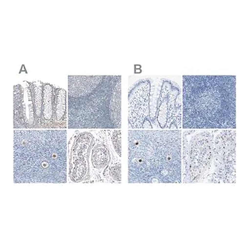 Merck Anti-SALL4 antibody produced in rabbit