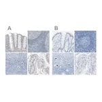 Merck Anti-SALL4 antibody produced in rabbit