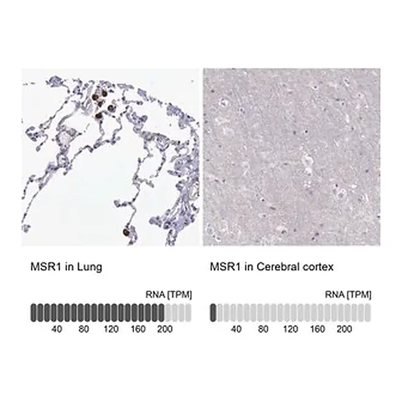 Merck Anti-MSR1 antibody produced in rabbit