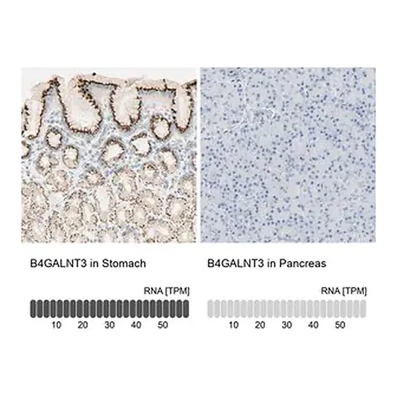Merck Anti-B4GALNT3 antibody produced in rabbit