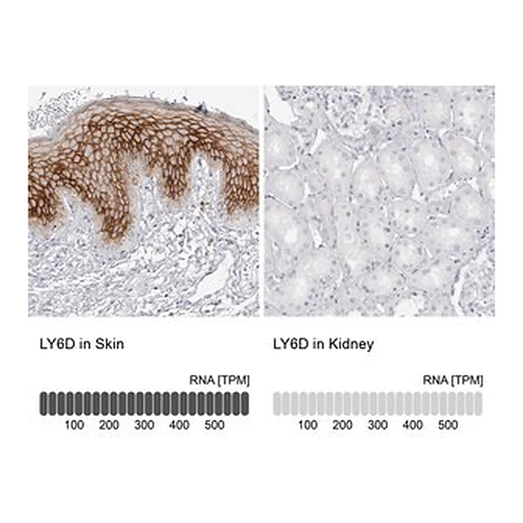 Merck Anti-LY6D antibody produced in rabbit
