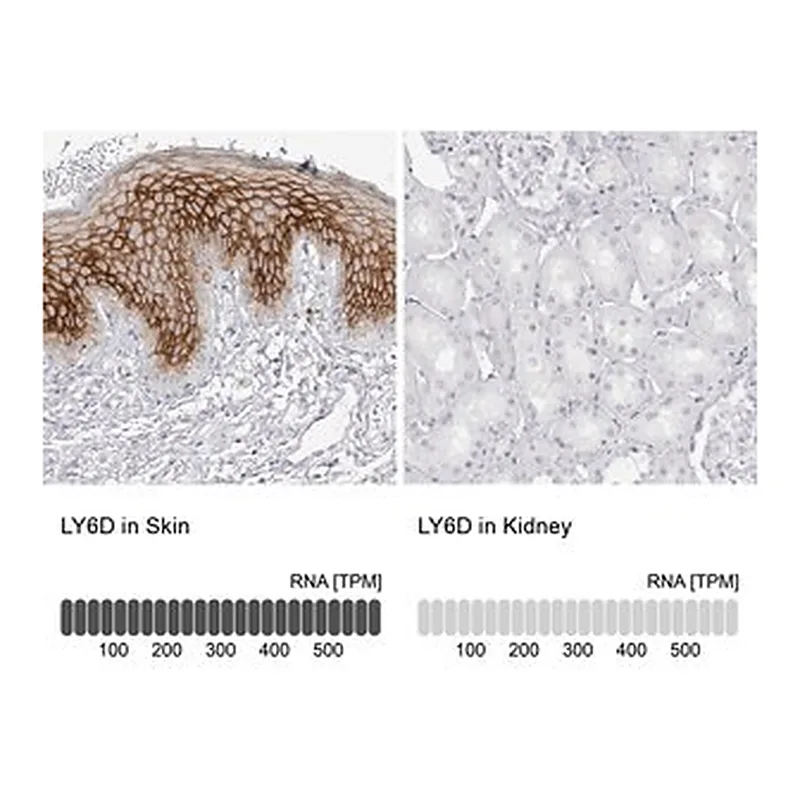 Merck Anti-LY6D antibody produced in rabbit