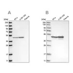 Merck Anti-FH antibody produced in rabbit