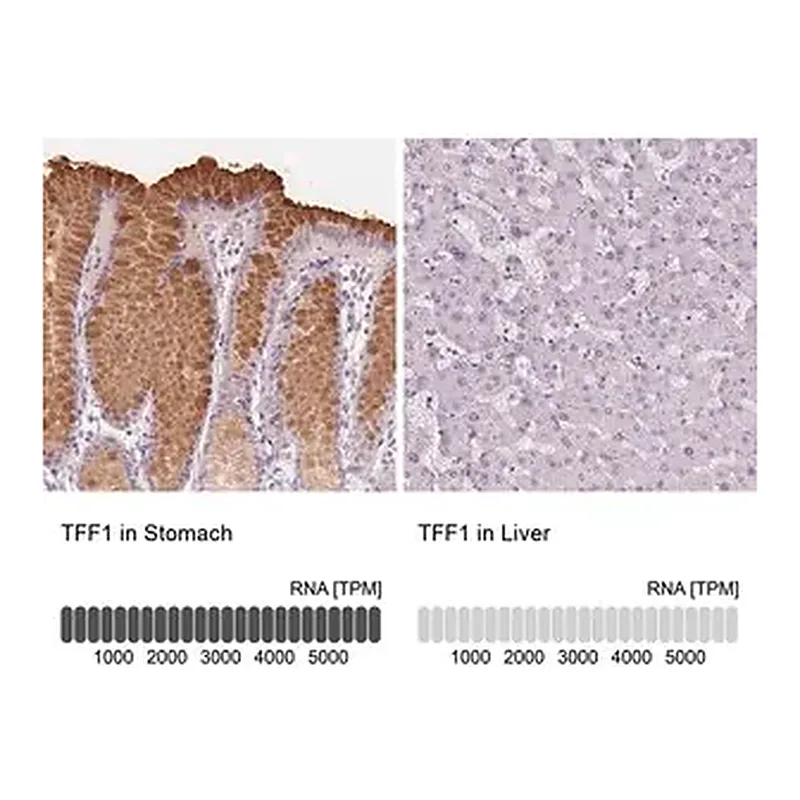 Merck Anti-TFF1 antibody produced in rabbit