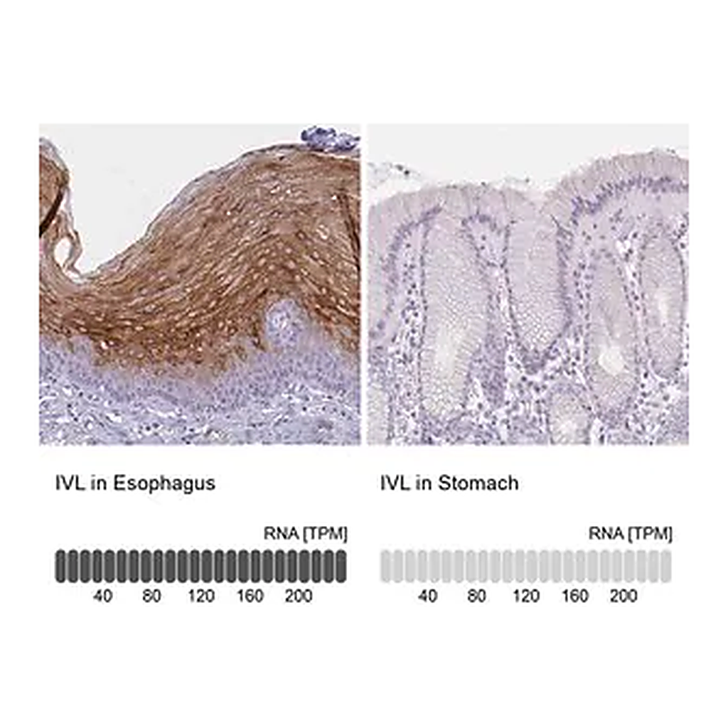 Merck Anti-IVL antibody produced in rabbit
