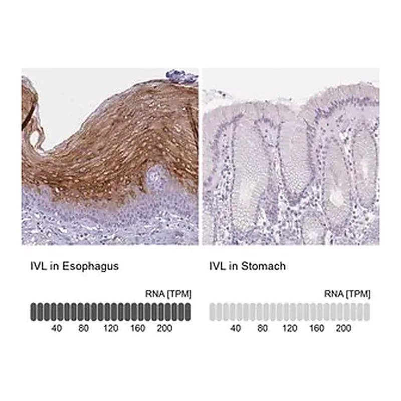 Merck Anti-IVL antibody produced in rabbit