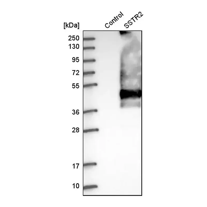 Merck Anti-SSTR2 antibody produced in rabbit