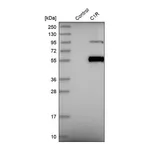 Merck Anti-C1R antibody produced in rabbit