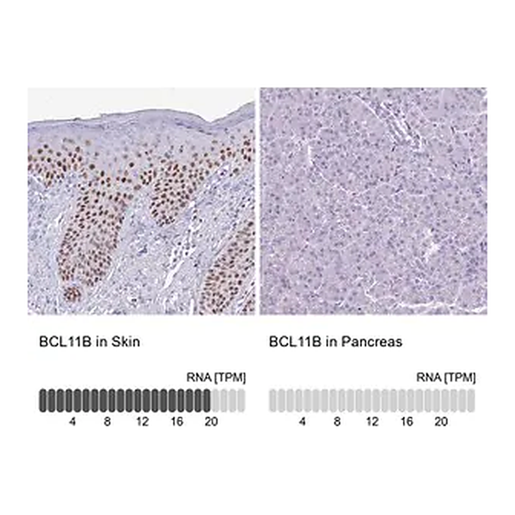 Merck Anti-BCL11B antibody produced in rabbit