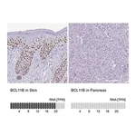 Merck Anti-BCL11B antibody produced in rabbit