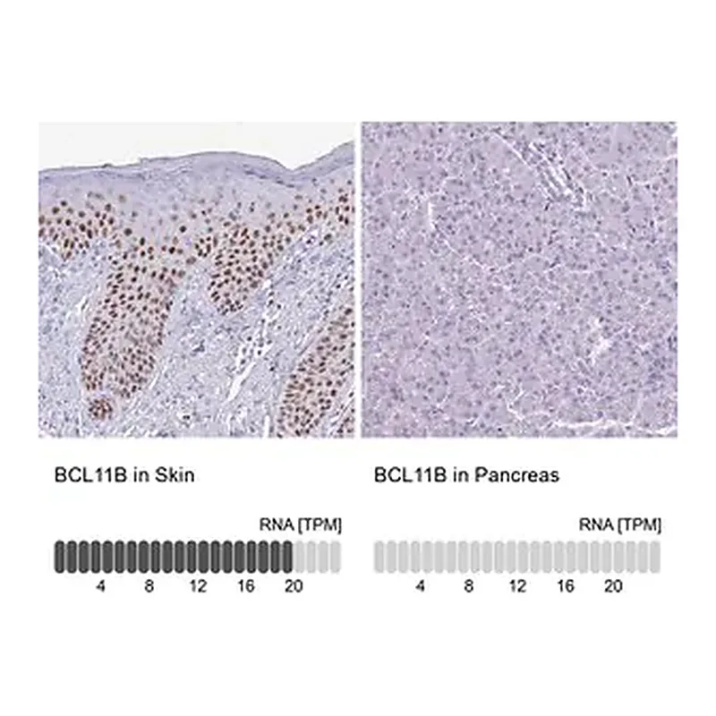 Merck Anti-BCL11B antibody produced in rabbit