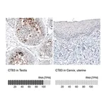 Merck Monoclonal Anti-CT83 antibody produced in mouse