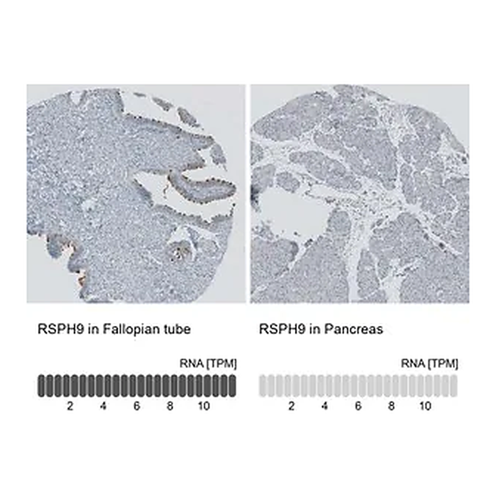 Merck Anti-RSPH9 antibody produced in rabbit