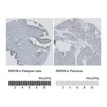 Merck Anti-RSPH9 antibody produced in rabbit