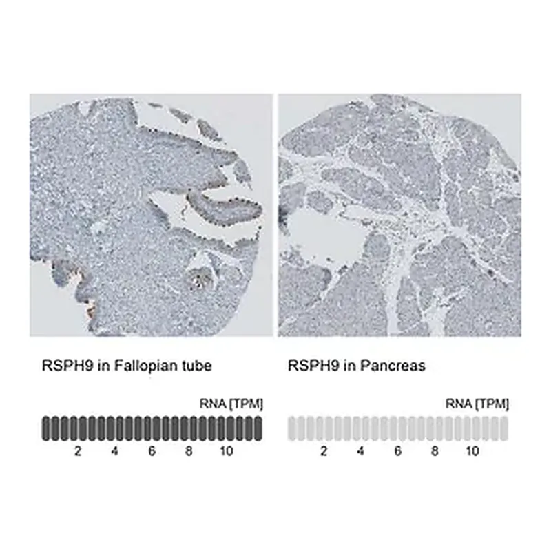 Merck Anti-RSPH9 antibody produced in rabbit