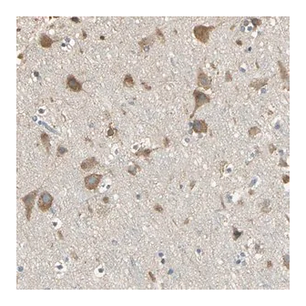 Merck Anti-ACSL4 antibody produced in rabbit