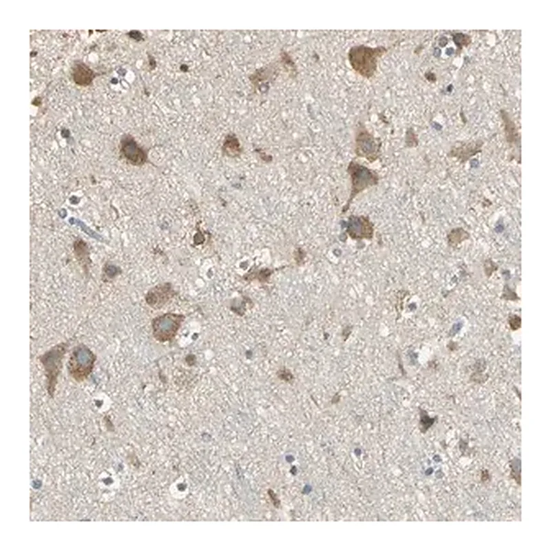 Merck Anti-ACSL4 antibody produced in rabbit