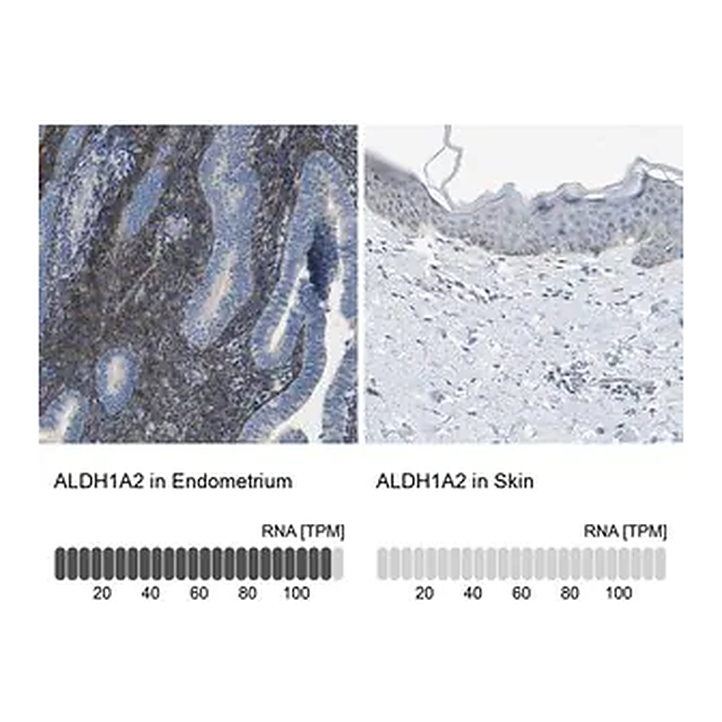 Merck Anti-ALDH1A2 antibody produced in rabbit