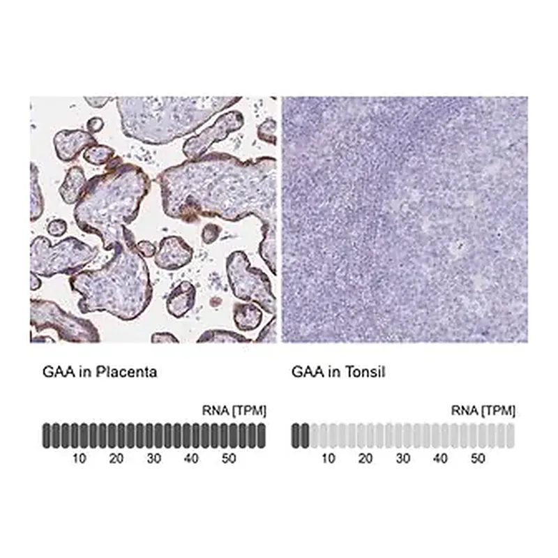 Merck Anti-GAA antibody produced in rabbit