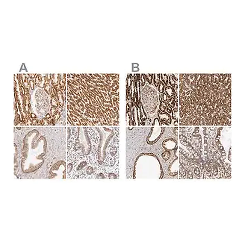 Merck Anti-ATP5B antibody produced in rabbit