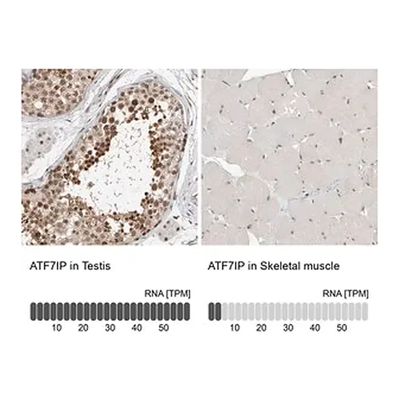 Merck Anti-ATF7IP antibody produced in rabbit