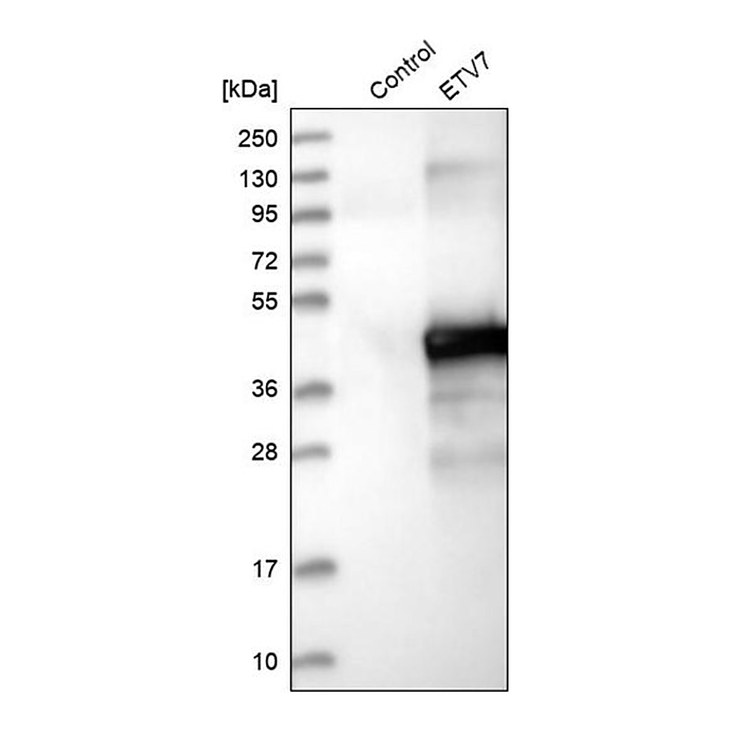 Merck Anti-ETV7 antibody produced in rabbit