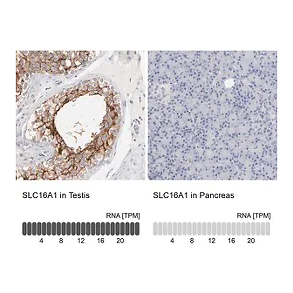 Merck Anti-SLC16A1 antibody produced in rabbit