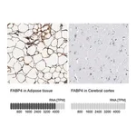 Merck Anti-FABP4 antibody produced in rabbit