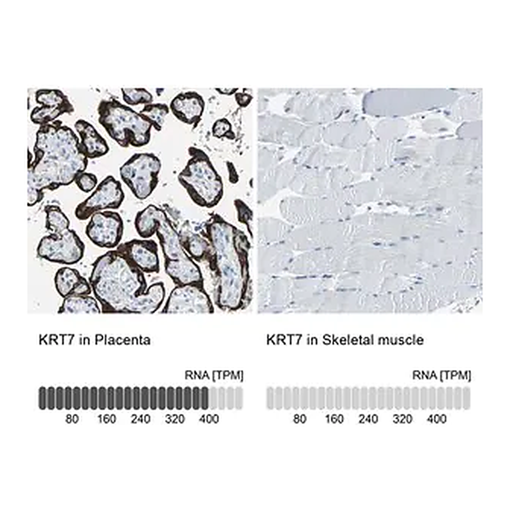 Merck Anti-KRT7 antibody produced in rabbit