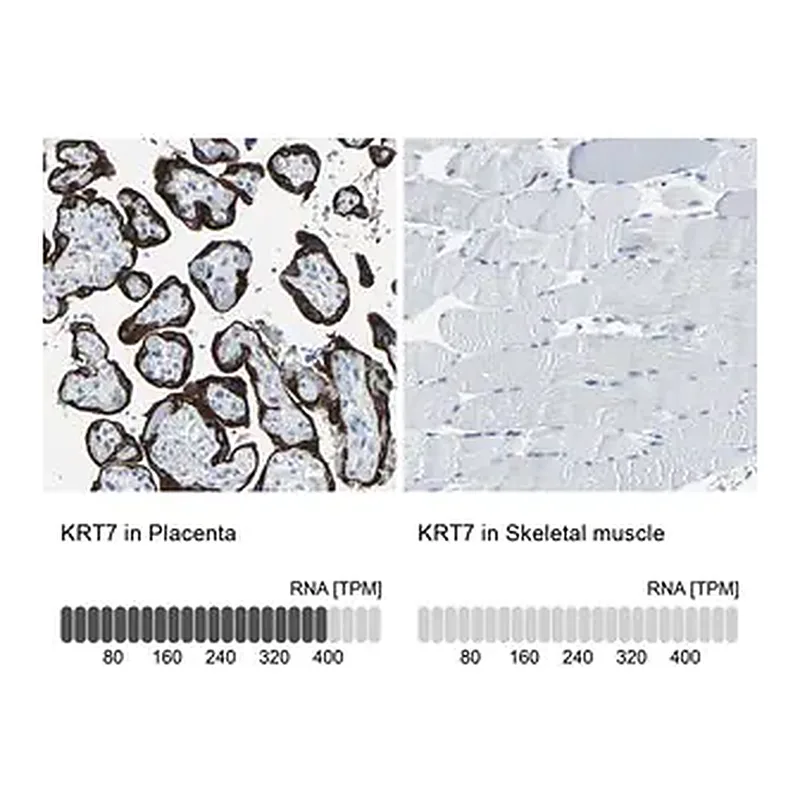Merck Anti-KRT7 antibody produced in rabbit