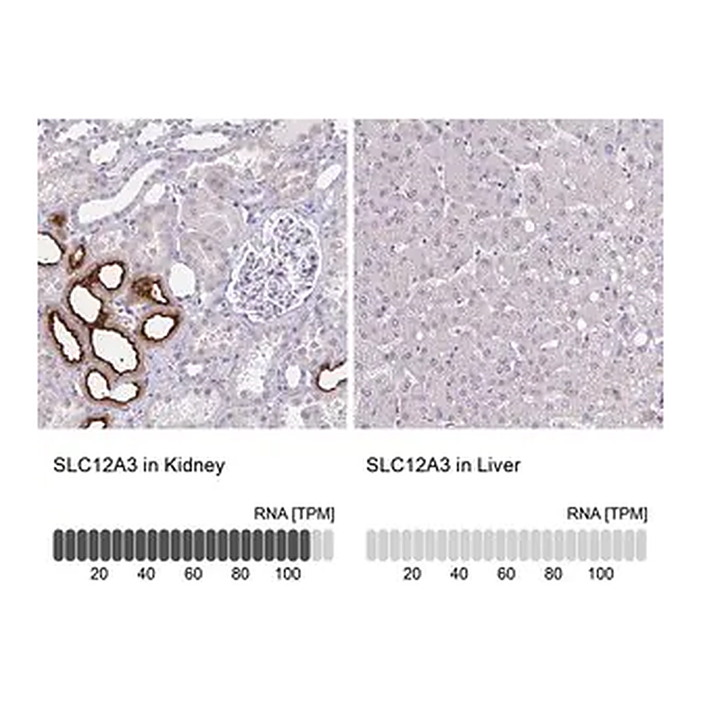 Merck Anti-SLC12A3 antibody produced in rabbit